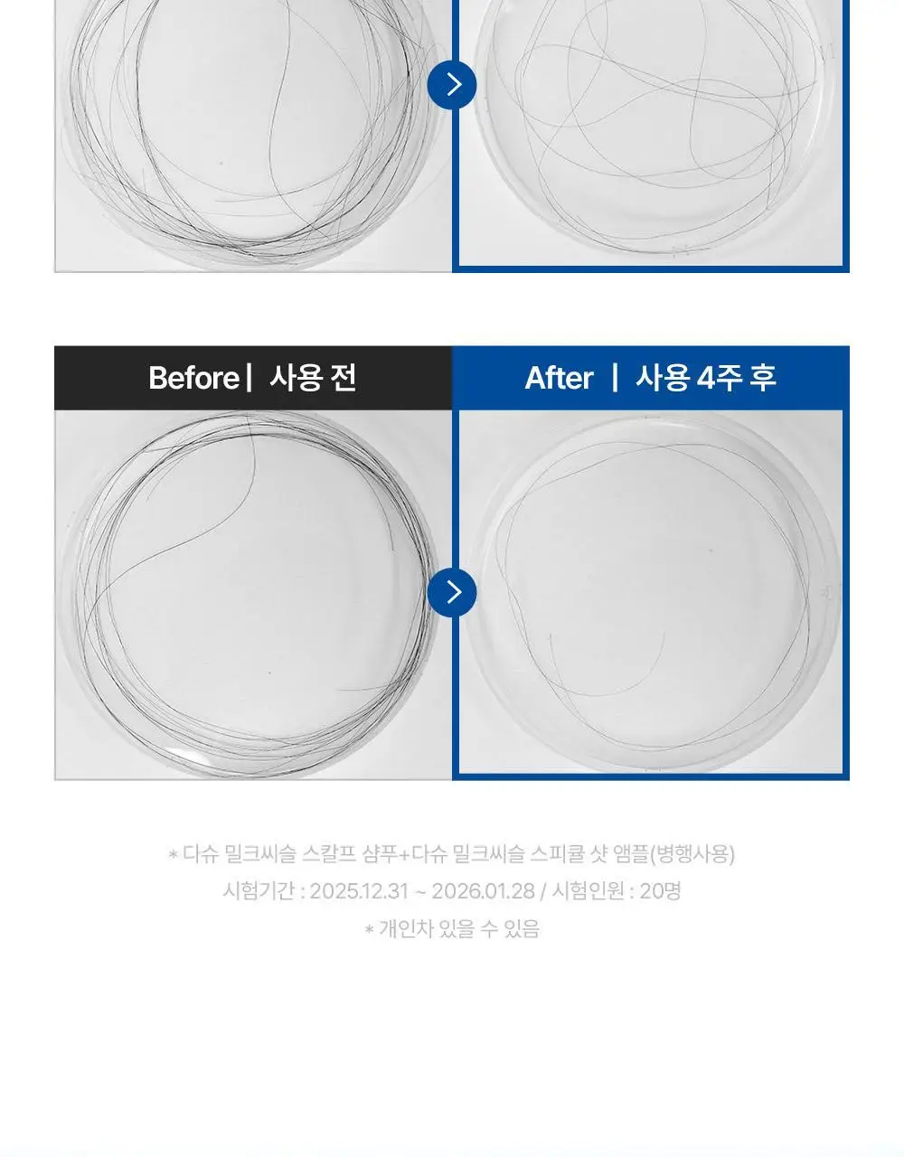 [M자복구앰플/두피괄사] 다슈 데일리 밀크씨슬 스피큘샷 스칼프 앰플 70ml 상세페이지 26